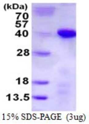 SDS-PAGE: Recombinant Human TCEA1 His Protein [NBP1-98993]