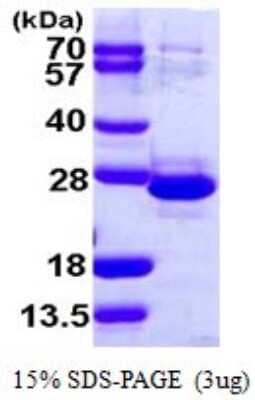 SDS-PAGE: Recombinant Human TCEAL1 His Protein [NBP1-72316]