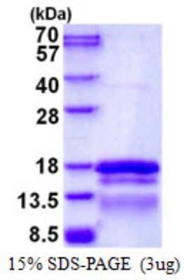 SDS-PAGE: Recombinant Human TCEAL7 His Protein [NBP1-98915]