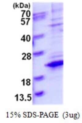 SDS-PAGE: Recombinant Human TCEAL8 His Protein [NBP1-98895]