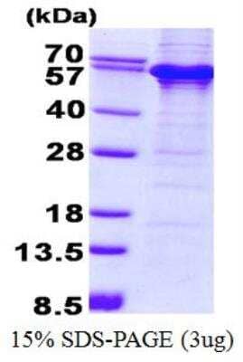 SDS-PAGE: Recombinant Human TDG His Protein [NBP2-22863]