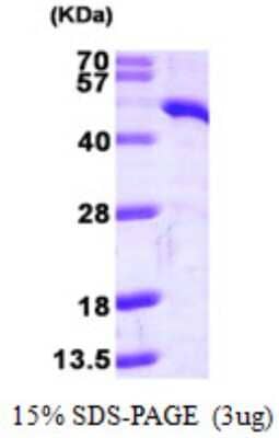 SDS-PAGE: Recombinant Human TDO2 His Protein [NBP1-51014]