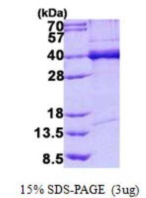 SDS-PAGE: Recombinant Human TDP-43/TARDBP His Protein [NBP2-22849]