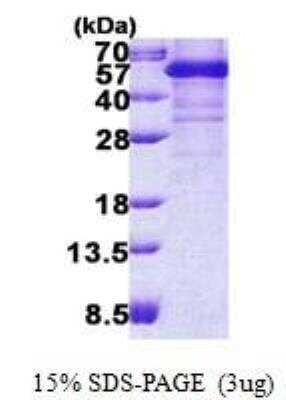 SDS-PAGE: Recombinant Human TDP-43/TARDBP His Protein [NBP2-22850]