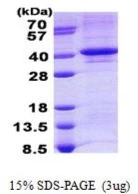 SDS-PAGE: Recombinant Human TDP1 His Protein [NBP2-22912]