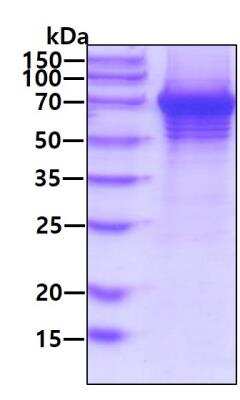 SDS-PAGE: Recombinant Human TDP1 His Protein [NBP2-59661]