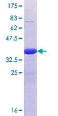 SDS-PAGE: Recombinant Human TET1 GST (N-Term) Protein [H00080312-Q01]