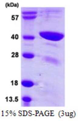 SDS-PAGE: Recombinant Human TFB1M His Protein [NBP1-72409]