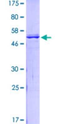 SDS-PAGE: Recombinant Human TFII-I GST (N-Term) Protein [H00002969-P01]