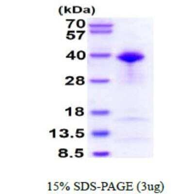 SDS-PAGE: Recombinant Human TFIIB His Protein [NBP1-30313]