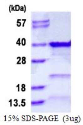 SDS-PAGE: Recombinant Human TFIIE beta His Protein [NBP1-98980]