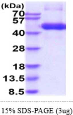 SDS-PAGE: Recombinant Human TGF-beta RI/ALK-5 Isoform 1 hIgG-His Protein [NBP2-61985]