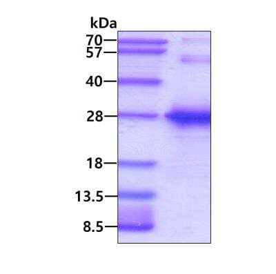 SDS-PAGE: Recombinant Human TGIF2LY His Protein [NBP2-51570]