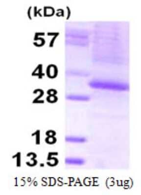 SDS-PAGE: Recombinant Human THAP1 His Protein [NBP1-99010]