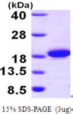 SDS-PAGE: Recombinant Human THEM2 His Protein [NBP1-49166]