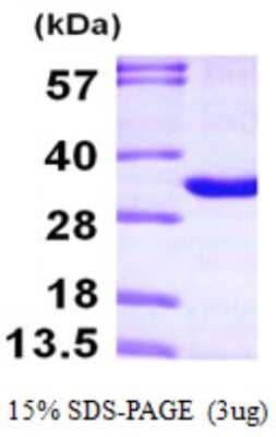 SDS-PAGE: Recombinant Human THYN1 His Protein [NBP1-49448]