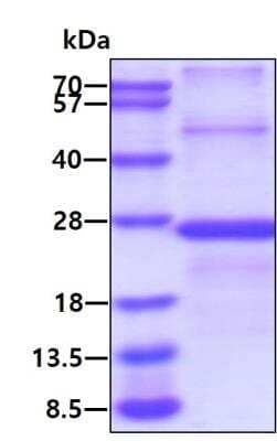 SDS-PAGE: Recombinant Human TIM-3 His Protein [NBP2-23118]