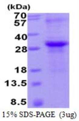 SDS-PAGE: Recombinant Human TIMP-2 His Protein [NBP2-22869]