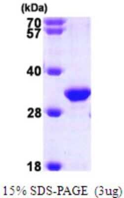 SDS-PAGE: Recombinant Human TIP30 His Protein [NBP1-50847]