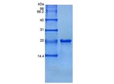 SDS-PAGE: Recombinant Human TL1A/TNFSF15 Protein [NBP2-35067]