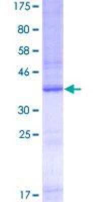 SDS-PAGE: Recombinant Human TLR9 GST (N-Term) Protein [H00054106-Q01]