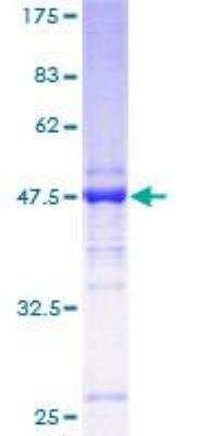 SDS-PAGE: Recombinant Human TMED2 GST (N-Term) Protein [H00010959-P01]