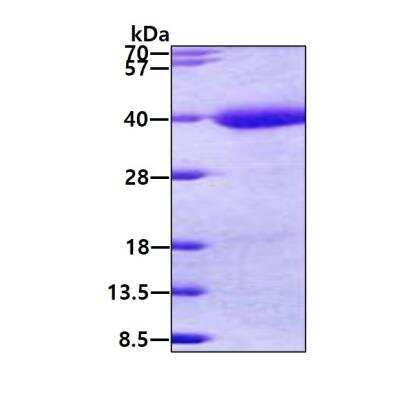 SDS-PAGE: Recombinant Human TMEFF1/Tomoregulin-1 His Protein [NBP2-22886]