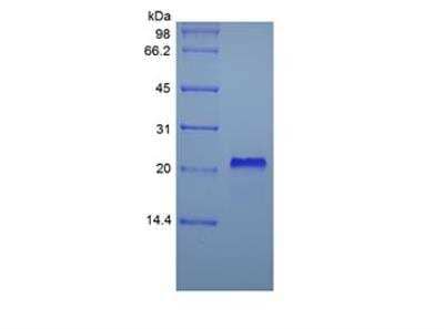 SDS-PAGE: Recombinant Human TNF RI/TNFRSF1A Protein [NBP2-35274]