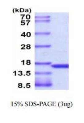 SDS-PAGE: Recombinant Human TNF-alpha Protein [NBC1-18460]