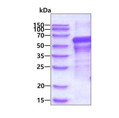 SDS-PAGE: Recombinant Human TNIP1 His Protein [NBP1-50866]