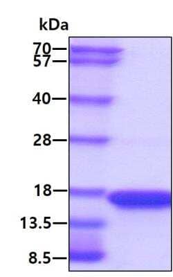 SDS-PAGE: Recombinant Human TOMM20 His Protein [NBP2-22883]