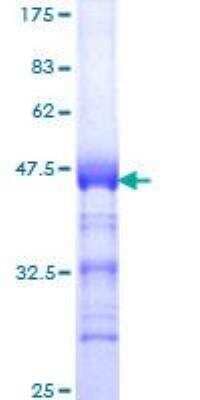 SDS-PAGE: Recombinant Human TOP2B GST (N-Term) Protein [H00007155-Q01]