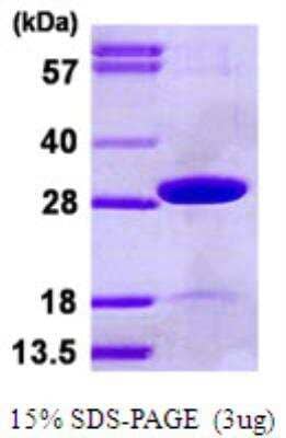 SDS-PAGE: Recombinant Human TPK1 His Protein [NBP1-99102]