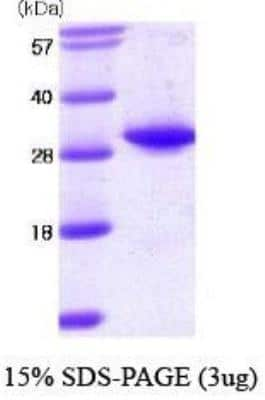 SDS-PAGE: Recombinant Human TPMT Protein [NBC1-18525]