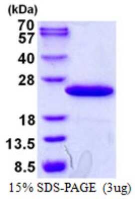 SDS-PAGE: Recombinant Human TPRKB His Protein [NBP1-98941]