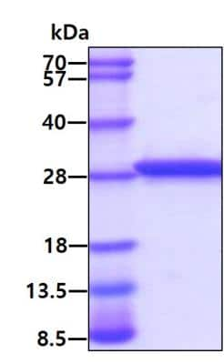 SDS-PAGE: Recombinant Human TPT1/TCTP His Protein [NBP1-37085]