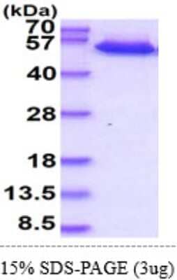 SDS-PAGE: Recombinant Human TRAILR2/TNFRSF10B Isoform 1 hIgG-His Protein [NBP2-61983]