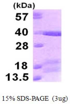 SDS-PAGE: Recombinant Human TRAM/TICAM2 His Protein [NBP1-78901]