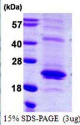 SDS-PAGE: Recombinant Human TRANCE/TNFSF11/RANK L His Protein [NBP1-72339]