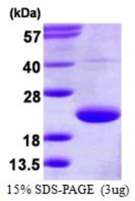 SDS-PAGE: Recombinant Human TRAPPC3 His Protein [NBP1-99070]