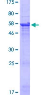 SDS-PAGE: Recombinant Human TRBV5-4 GST (N-Term) Protein [H00028611-P01]