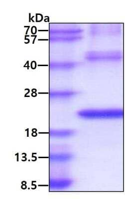 SDS-PAGE: Recombinant Human TREM2 His Protein [NBP2-22888]