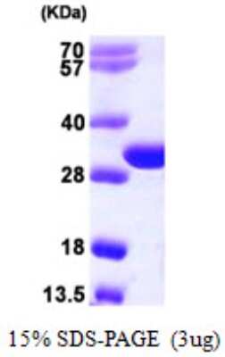 SDS-PAGE: Recombinant Human TREX2 His Protein [NBP1-51040]