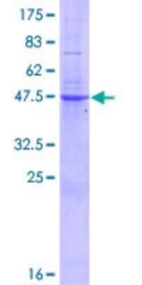 SDS-PAGE: Recombinant Human TRGV3 GST (N-Term) Protein [H00006976-P01]