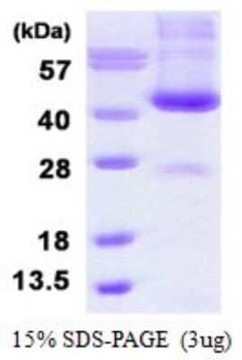 SDS-PAGE: Recombinant Human alcohol dehydrogenase 6 His Protein [NBP1-98964]