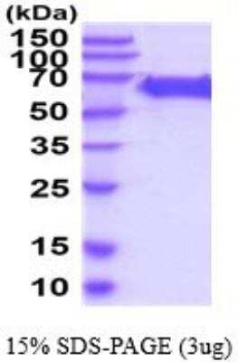 SDS-PAGE: Recombinant Human TRP2 His Protein [NBP2-53051]