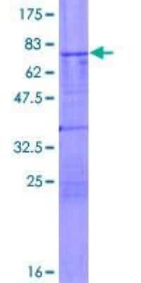 SDS-PAGE: Recombinant Human TSG101 GST (N-Term) Protein [H00007251-P01]