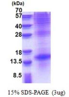 SDS-PAGE: Recombinant Human TSH beta His Protein [NBP2-22866]