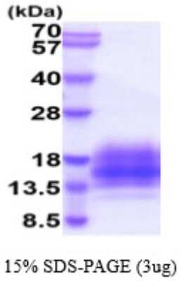 SDS-PAGE: Recombinant Human TSPAN7/TM4SF2 His Protein [NBP2-59575]