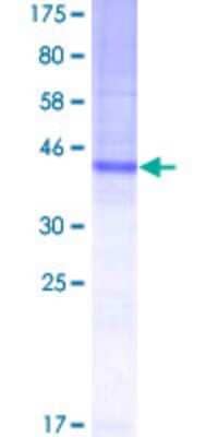 SDS-PAGE: Recombinant Human TSPAN8/TM4SF3 GST (N-Term) Protein [H00007103-P01]